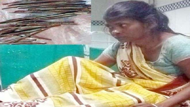 bleeding nails from feets,weird disease,weird story