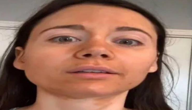 खूबसूरती बढ़ाने के लिए लड़की ने चहरे पर लगाई क्रीम, सुबह हुआ कुछ ऐसा कि आ गई सकते में