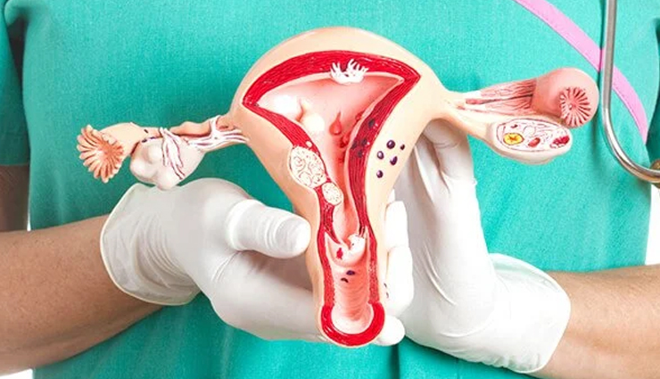 health problems associated with women,women health tips,Health tips,fitness tips