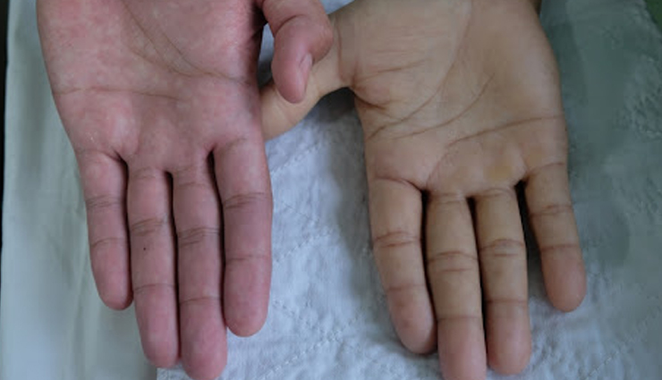 health problems associated with women,women health tips,Health tips,fitness tips