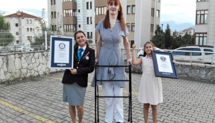 बीमारी की वजह से बना दुनिया की सबसे लंबी महिला होने का रिकॉर्ड, दूसरी बार हुआ नाम दर्ज 