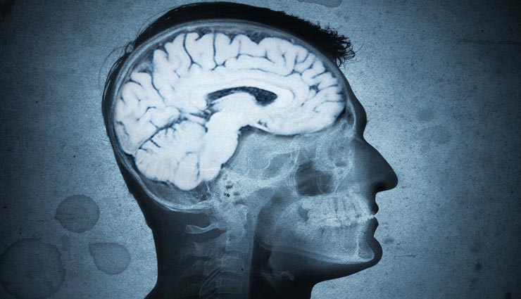 यह शख्श 30 साल से कर रहा था मिर्गी की दवाई का सेवन, सच्चाई पता चलने पर खिसक गई पैरों तले जमीन weird medical case,weird disease,china,worm lived in mans brain,mans causing headaches and seizures