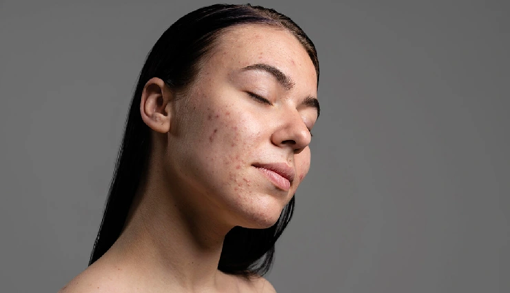 15 Habits That are Worst For Your Skin