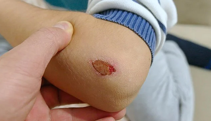 गुणों की खान है करेला, जानें किस तरह पहुंचाता हैं सेहत को फायदे bitter gourd,bitter gourd health benefits,healthy food bitter gourd,bitter gourd for good health,bitter gourd benefits in hindi