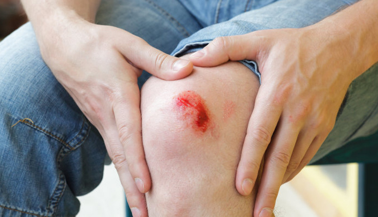 8 Things That Would Affect Wound Healing