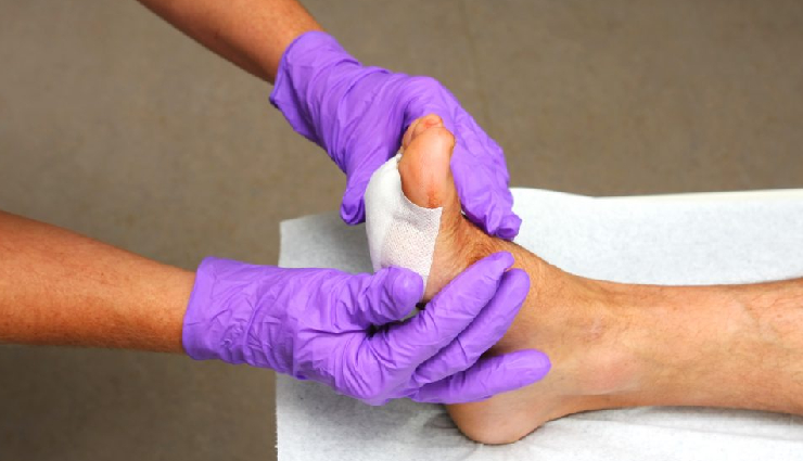 wound healing factors,impact of overall health on wounds,age and wound healing,obesitys effect on wound healing,trauma type and healing rate,importance of skin moisture in healing,chronic conditions and wound recovery,medications affecting wound healing,proper wound care techniques,strategies for faster wound healing,maintaining skin moisture for healing,delayed healing due to medications,managing chronic conditions for wound recovery