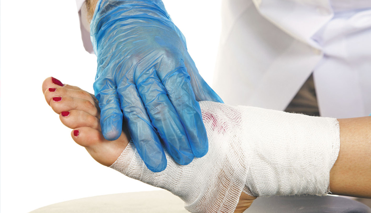 eucalyptus oil,eucalyptus oil health benefits,eucalyptus oil for good health,stuffy nose,clears respiratory complaints,eases sore muscle and joint pain,post-surgery pain reliever,promotes oral health,promotes scalp health and clear lice,boosts immunity,disinfects wounds and cuts,insects and rodents repellent,controls blood sugar,reduces stress,Health,Health tips