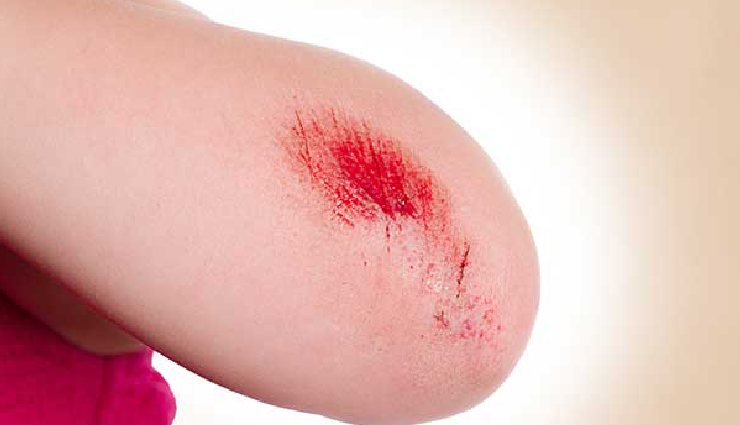 milk and honey for face,benefits of milk and honey on face,using milk and honey for facial skin,milk and honey face mask benefits,natural face benefits of milk and honey,milk and honey face remedies,facial benefits of milk and honey,skin advantages of milk and honey,face care with milk and honey,milk and honey facial treatments