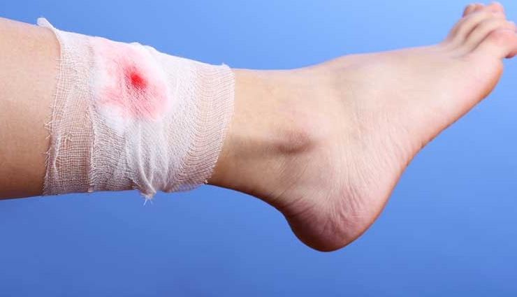 diy tea tree oil for skin,tea tree oil benefits for hair,how to use tea tree oil for acne,tea tree oil scalp treatment,natural remedies with tea tree oil,tea tree oil for dandruff control,tea tree oil hair growth diy,tea tree oil antifungal remedies