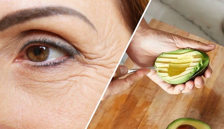 5 Ways To Use Avocado To Treat Wrinkles
