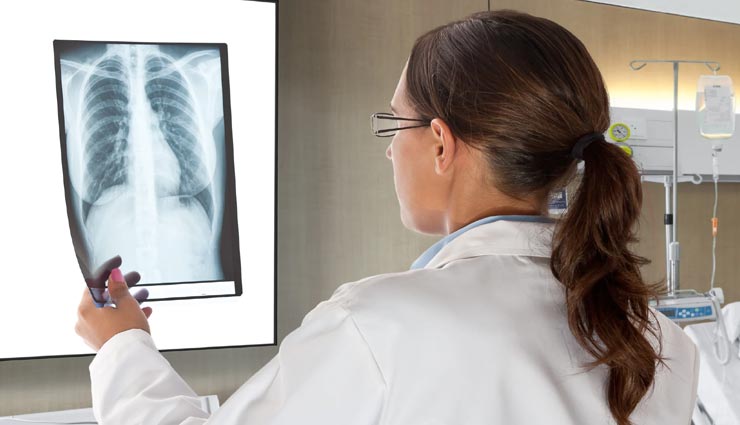 खांसी का इलाज कराने गई थी युवती और सामने आई सच्चाई ने डॉक्टर्स को भी कर दिया हैरान