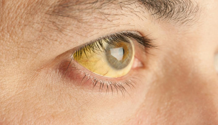 कई खतरनाक बीमारियों का कारण बनते हैं मच्छर, शुरू कर दीजिए सावधानी बरतना mosquito-borne diseases and precautions,protecting against mosquito-borne illnesses,dangers of mosquitoes and disease prevention,mosquito-borne infections and preventive measures,preventing diseases transmitted by mosquitoes,mosquito-borne illness prevention tips,importance of mosquito precautions for health,mosquito-borne diseases and proactive measures,safeguarding against mosquito-borne viruses,taking precautions against mosquito-related diseases