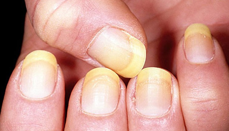 baking soda benefits for skin and hair,uses of baking soda for skin and hair,baking soda benefits in skincare and haircare,how baking soda benefits skin and hair health,baking soda for skin and hair wellness,benefits of using baking soda for skin and hair,baking soda advantages for skin and haircare routine,skincare and haircare benefits of baking soda,baking soda positive effects on skin and hair,baking soda properties for healthy skin and hair,baking soda beauty benefits,baking soda for skincare and haircare,skin and hair benefits of baking soda,baking soda remedies for skin and hair,baking soda advantages for beauty,baking soda uses for skin and hair health,baking soda natural beauty solutions,baking soda benefits for healthy skin and hair,baking soda properties for skin and hair care,beauty benefits of incorporating baking soda