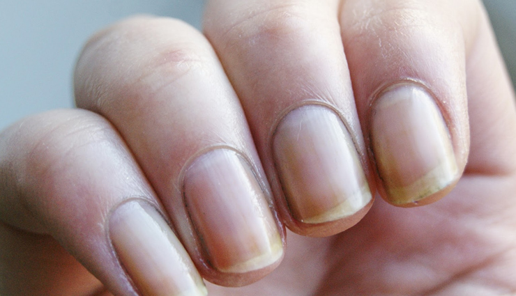 natural remedies to treat yellow nails,beauty tips,beauty hacks