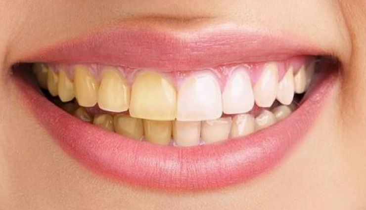 baking soda benefits for skin and hair,uses of baking soda for skin and hair,baking soda benefits in skincare and haircare,how baking soda benefits skin and hair health,baking soda for skin and hair wellness,benefits of using baking soda for skin and hair,baking soda advantages for skin and haircare routine,skincare and haircare benefits of baking soda,baking soda positive effects on skin and hair,baking soda properties for healthy skin and hair,baking soda beauty benefits,baking soda for skincare and haircare,skin and hair benefits of baking soda,baking soda remedies for skin and hair,baking soda advantages for beauty,baking soda uses for skin and hair health,baking soda natural beauty solutions,baking soda benefits for healthy skin and hair,baking soda properties for skin and hair care,beauty benefits of incorporating baking soda