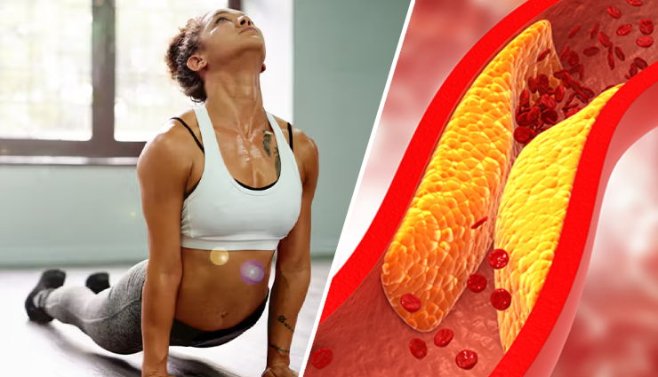 बढ़ते हुए कोलेस्ट्रॉल को लाना हैं नियंत्रण में, इन 6 योगासन को बनाए दिनचर्या का हिस्सा 