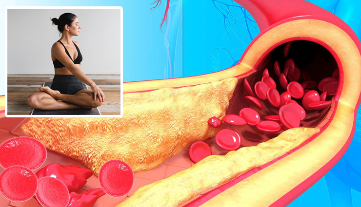 4 Yoga Asanas To Help You Lower High Cholesterol