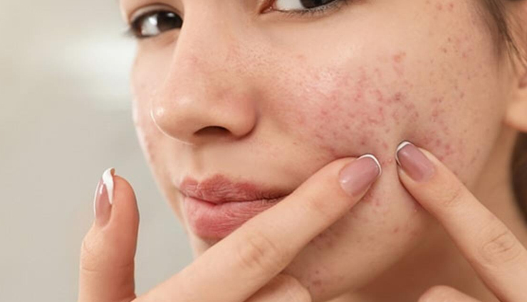 diy yogurt face mask,skin care tips,beauty tips