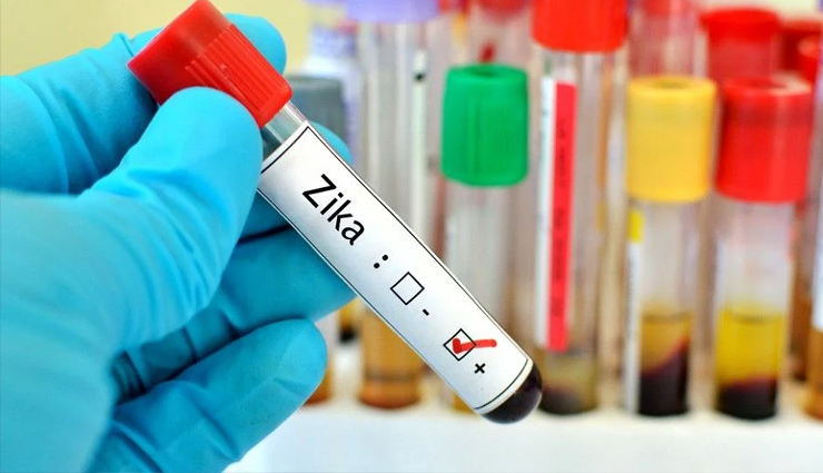 zika visus symptoms,zika virus vaccine,zika virus treatment,zika virus symptoms,zika virus preventions,zika virus outbreak in india,zika virus kanpur,zika virus in india,zika virus causes,zika virus cases,where does zika virus come from,what happens if you get the zika virus,Health,Health tips