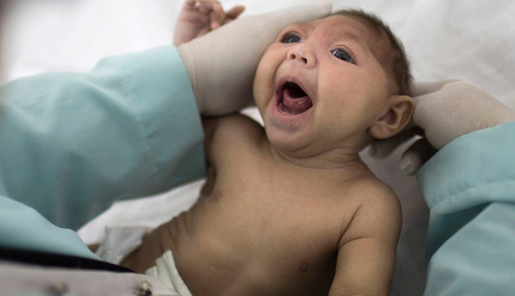 कई खतरनाक बीमारियों का कारण बनते हैं मच्छर, शुरू कर दीजिए सावधानी बरतना mosquito-borne diseases and precautions,protecting against mosquito-borne illnesses,dangers of mosquitoes and disease prevention,mosquito-borne infections and preventive measures,preventing diseases transmitted by mosquitoes,mosquito-borne illness prevention tips,importance of mosquito precautions for health,mosquito-borne diseases and proactive measures,safeguarding against mosquito-borne viruses,taking precautions against mosquito-related diseases