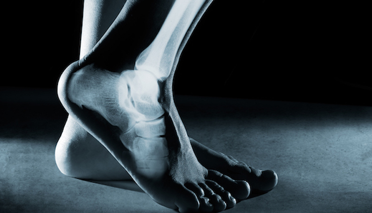 zucchini,health benefits of zucchini health tips,fitness tips