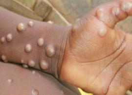 இந்தியாவில் குரங்கு அம்மை நோயால் பாதிக்கப்பட்டவர் முழுவதுமாக மீண்டார்