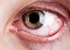 கண் உலர் நோயை போக்க என்ன செய்யலாம்... சில டிப்ஸ்