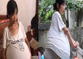 வயிறு மட்டும் இருபது கிலோ; எதனால் என்று தெரியலையே!