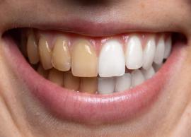 பற்கள் பளிச்சென்று இருக்க என்ன செய்யலாம்... இதோ உங்களுக்கு சில யோசனைகள்