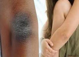 முழங்கையில் அசிங்கமாக உள்ள கருமை: எளிய முறையில் நீக்கலாம்