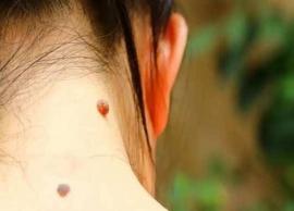 அழகை கெடுக்கும் மருக்களை போக்க எளிய வழிகள்!!!