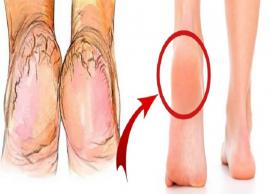 பாத வெடிப்புக்கு சரியான எளிமையான தீர்வு இதோ உங்களுக்காக!!!