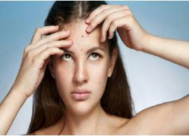 முகப்பருக்களை தவிர்க்க சில யோசனைகள் உங்களுக்கு!!!