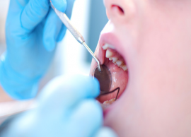 பற்சொத்தை உள்பட பல்வேறு பல் பிரச்சினைகளை தவிர்ப்பது எப்படி ?