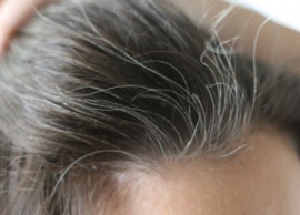 இளம் நரையால் ஏற்படும் வேதனைகளை போக்க சில யோசனைகள்