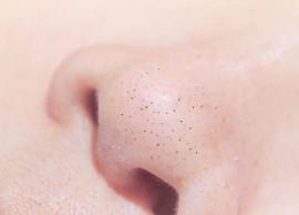 பிளாக்ஹெட்ஸை போக்கி சருமத்தை மென்மையாக்க சில குறிப்புகள்!