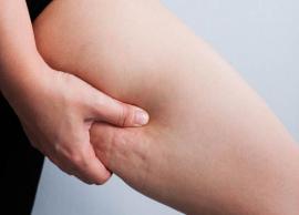 அழகை கெடுக்கும் செல்லுலைட் பிரச்சனை உங்களுக்கு இருக்கிறதா?