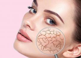 முகம் பார்க்க மிகவும் வறண்டு காணப்படுகிறதா..?