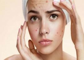 பருக்கள் வருவதைத் தடுக்க இந்த வழிமுறைகளை பின்பற்றுங்கள்!