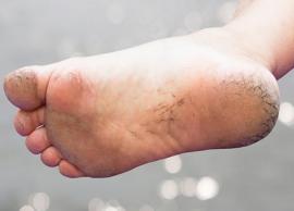 கால்களின் அழகை கெடுக்கும் குதிகால் வெடிப்பு ஏன் ஏற்படுகிறது?