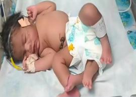 குவாலியர் மாவட்டத்தில் நான்கு கால்களுடன் பிறந்த பெண் குழந்தை