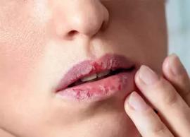 உதடுகளில் ஏற்படும் வெடிப்புகளை சரி செய்ய இயற்கை தீர்வுகள்!