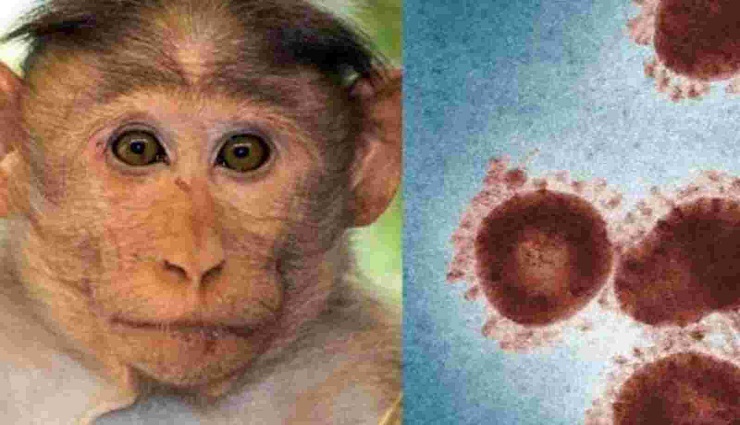 monkey measles,kerala ,குரங்கு அம்மை,கேரளா