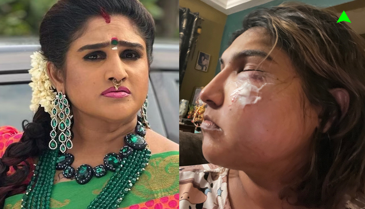 pradeep,x site,description,vanitha vijayakumar,registration,attack ,பிரதீப், எக்ஸ் தளம், விளக்கம், வனிதா விஜயகுமார், பதிவு, தாக்குதல்