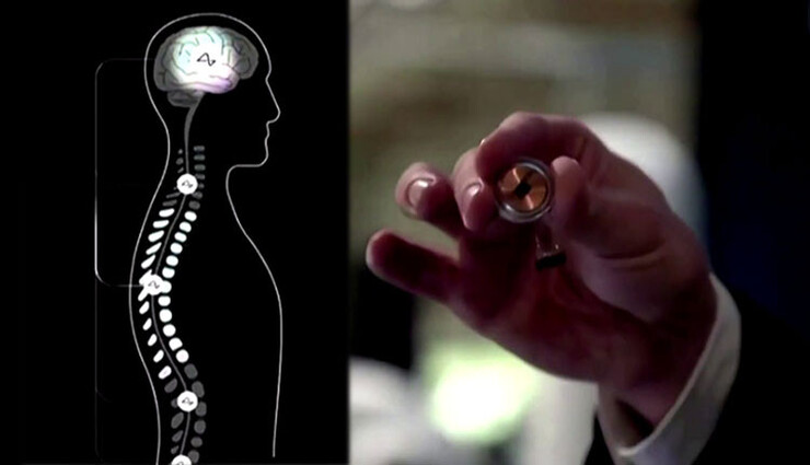 நியூராலிங் நிறுவனத்தின் சிப்களை மனிதர்களிடம் சோதனை செய்ய அனுமதி