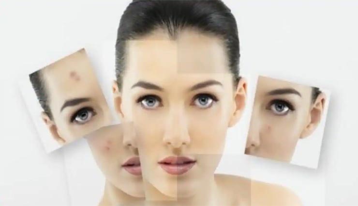 face,beauty,bleaching,dead cells,darkening ,முகம்,அழகு,பிளீச்சிங்,இறந்த செல்கள்,கருமை