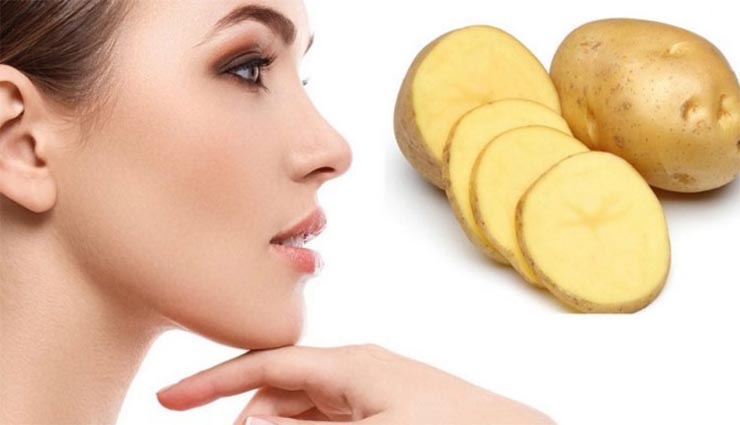 dark spots,face,beauty,natural,potatoes ,கரும் புள்ளிகள்,முகம்,அழகு,இயற்கை,உருளைக்கிழங்கு