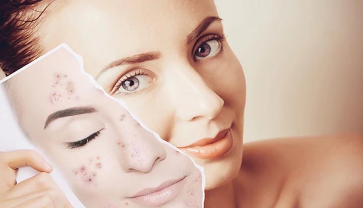 கரும் புள்ளிகள் மாறி முகம் பளபளப்பாக மாற..!