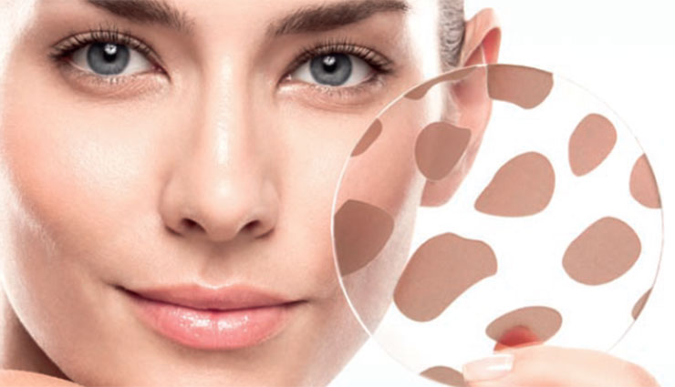 ముఖంపై నల్లమచ్చలు తగ్గుటకు అవసరమైన చిట్కాలు